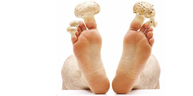 Onychomycosis OM (Toe Fungus) Treatments at Clínica Privé