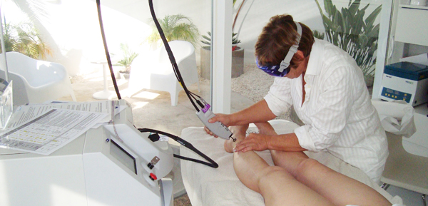 Laser Vascular Vbeam na Clínica Privé MEDSPA