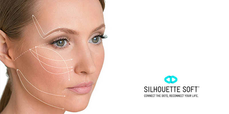 Silhouette Soft Lift at Clínica Privé